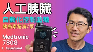 人工胰臟，胰島素幫浦自動化幫助你控制血糖，美敦力Medtronic 780G pump Review [upl. by Gnoh407]