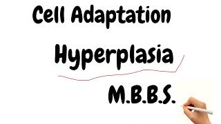 Cell Adaptation Part 2 Hyperplasia  Pathology Notes  Pathology MBBS Notes [upl. by Naugan]