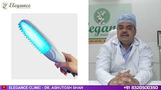 UVB Therapy for Vitiligo  Radiation Treatment Vitiligo Skin in Valsad Bardoli Surat [upl. by Ybanrab]