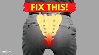 How to Fix Tailbone Pain for Good [upl. by Norrat]