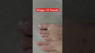 Removing my TOENAIL with a MINIGUN funny science comedy [upl. by Llenoj]