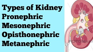 Types of kidney Pronephric Mesonephric Opisthonephric Metanephric for NEET BSc MSc CSIR [upl. by Anirehtak]