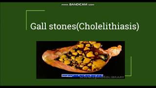 Cholelithiasis  Gallstones Pathogenesis amp Morphology [upl. by Liahkim705]