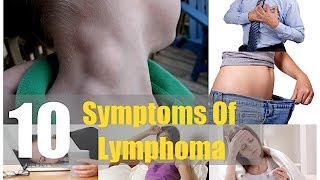 Top 10 Symptoms of Lymphoma Ignored by Men and Women Swollen Lymph Nodes Lymph Glands [upl. by Wanonah]