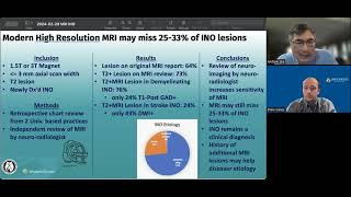 Internuclear Ophthalmoplegia INO on MRI [upl. by Catlee736]