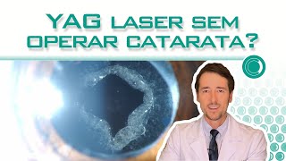 YAG laser sem operar catarata [upl. by Melentha447]