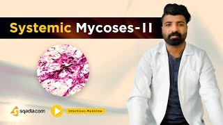 Systemic Mycoses II  Infectious Medicine Video  Medical Student Lectures  VLearning [upl. by Thurmann]