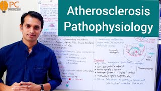 Atherosclerosis Pathophysiology  Etiology and Pathogenesis of Atherosclerosis [upl. by Nolyar747]