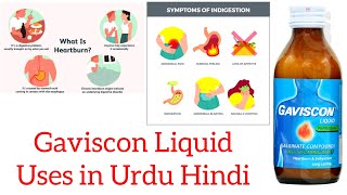 gavisçon syrup uses in urdu Hindi [upl. by Anesuza]