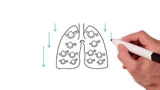 Everything you need to know about the ventilation perfusion ratio [upl. by Belden]