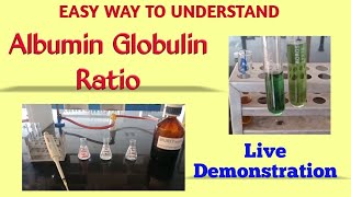 Albumin globulin ratio  Total protein estimation  Biuret method  Albumin estimation  BCG method [upl. by Ayom624]