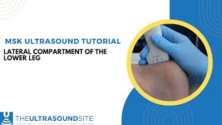 Musculoskeletal ultrasound evaluation of the lateral compartment of the lower leg [upl. by Odille275]