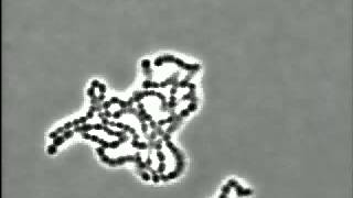 Bacteria Streptococcus pyogenes [upl. by Marijn]