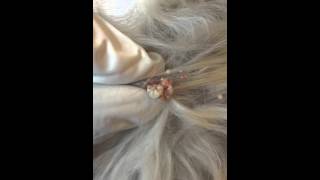 Hair follicle tumor in a dog [upl. by Nessnaj10]