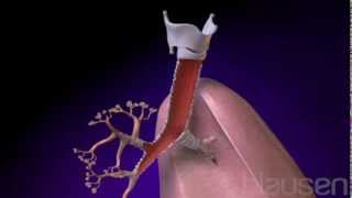 Bronchitis Animation [upl. by Atiken]