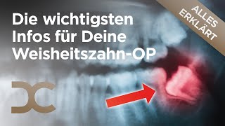 Weisheitszähne entfernen Alles zur schonenden WeisheitszahnOP in Dämmerschlaf  Dorow Clinic [upl. by Sheff]