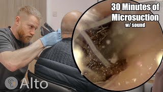 30 Minutes of MICROSUCTION Ear Wax Removal [upl. by Nicolau]