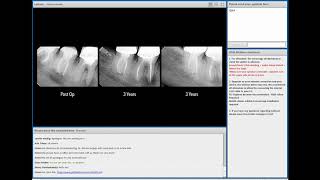 VDW Dental · Webinar The Endodontic Essentials with Dr Marino Sutedjo EN [upl. by Ebsen]