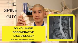 Lumbar Degenerative Disc Disease Part 1 Symptoms and Imaging [upl. by Grimbly249]