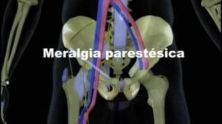 Meralgia Parestésica [upl. by Mathews]