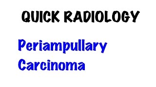 QUICK RADIOLOGY Periampullary carcinoma [upl. by Riffle]