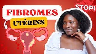 FIBROMES UTÉRINS  UN PROBLÈME MAJEUR POUR LES FEMMES NOIRES CE QUE VOUS DEVEZ SAVOIR [upl. by Coryden]