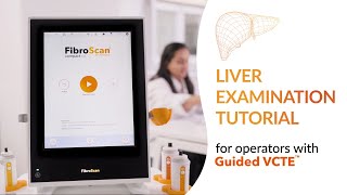 Tutorial liver examination with FibroScan® and Guided VCTE™ [upl. by Skeie]