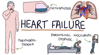 Understanding Heart Failure Visual Explanation for Students [upl. by Atiekal850]