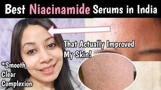 Best Niacinamide Serums For All Skin Types Minimalist 5 Niacinamide Niamax D gel Vs Suganda [upl. by Sarnoff]