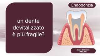 Endodonzia che cosè [upl. by Ahsinuq161]