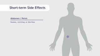 Side Effects of Radiation Therapy  SERO [upl. by Bautram]