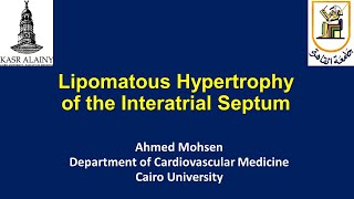 Lipomatous hypertrophy of the Interatrial Septum Lipomatous atrial septal hypertrophy LASH [upl. by Ordnasil681]