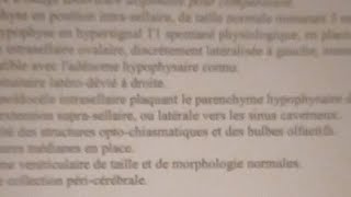 Hyperprolactinémie adénome hypophysaire Dostinex Parlodel  bilan médical et FAQ [upl. by Annekcm685]