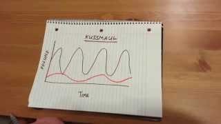 Kussmaul Respiration [upl. by Demitria]