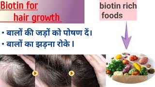 BIOTIN  nourish the hair roots I top biotin rich foods  10 दिन में naturally बायोटिन बढ़ाएँ I [upl. by Rosabella]