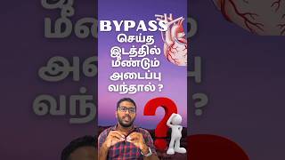 பைபாஸ் செய்த இடத்தில் அடைப்பு ஏற்பட்டால் bypass stenting ytshorts tamilhealthtips [upl. by Annamarie355]