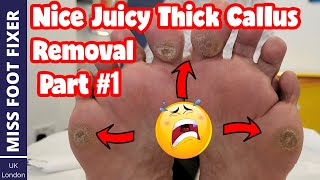 Part 1  Nice Thick Juicy Callus Removal Full Treatment By Miss Foot Fixer [upl. by Clifton]