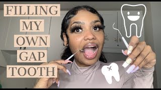 DIY DENTIST  CLOSED THE GAP IN MY TEETH MYSELF  BEAUTY BY PRIMA [upl. by Enitsej521]