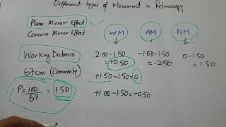 Different types of movement in Retinoscopy [upl. by Annetta]