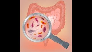 Clostridium Difficile  C Difficile symptoms  C Difficile treatment  Pseudomembranous colitis [upl. by Irwinn290]