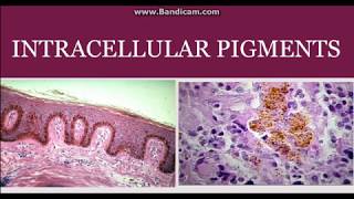 Intracellular pigments [upl. by Laeira797]