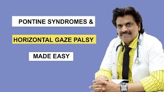 PONTINE SYNDROMES amp HORIZONTAL GAZE PALSY MADE EASY [upl. by Eanom]