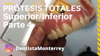 PASOS Prácticos PrótesisTotales👅Parte4 Prueba dientesAjustesPrótesisTerminada DentaduraCompleta [upl. by Vasta831]