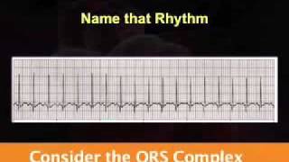 Introduction to EKG Rhythm Interpretation Part 2 [upl. by Fira]