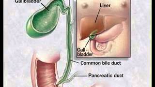 Bladder cancer symptoms [upl. by Mairb]