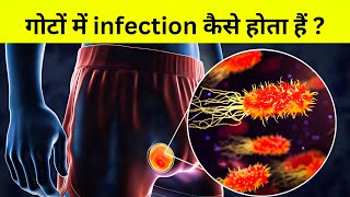 मर्द हो तो ज़रूर देखना  मर्दों के गोटों में infection [upl. by Mcbride977]