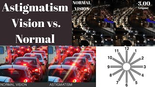 Astigmatism Vision vs normal Astigmatism Symptoms What is astigmatism [upl. by Kevyn618]