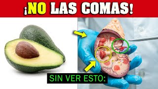 ¡ALERTA quienes NO DEBERÍAN Comer AGUACATE 🥑 Palta ⛔ [upl. by Nnad]