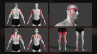 trigger point explained with animation [upl. by Nosreip]