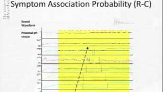 Acoustic Cough Reflux Associations in Chronic Cough [upl. by Scheck]